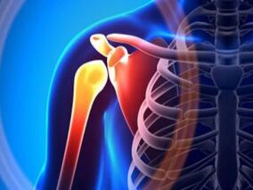 Sorbalda artikulazio hanturatua artrosiaren ondorioz - muskulu-eskeleto-sistemaren gaixotasun kronikoa