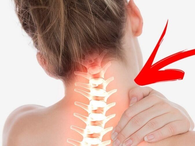Nerbio sustraien konpresioa osteochondrosis cervikala