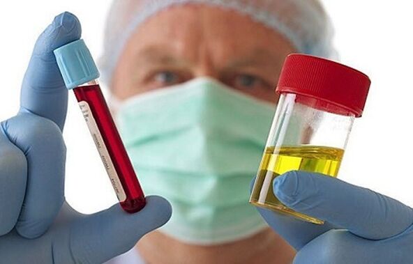 Bizkarrezurreko bizkarrezurraren osteochondrosia diagnostikatzeko moduak