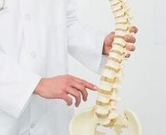 Lumbar osteochondrosia